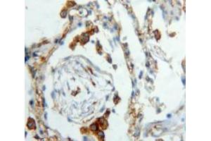 IHC-P analysis of Lung tissue, with DAB staining. (XCL1 Antikörper  (AA 23-113))