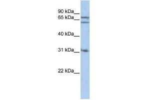 Gephyrin antibody used at 1 ug/ml to detect target protein. (Gephyrin Antikörper  (Middle Region))