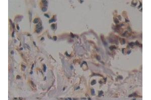 Immunohistochemistry (IHC) image for anti-Creatine Kinase, Mitochondrial 1A (CKMT1A) (AA 41-250) antibody (ABIN7431470)
