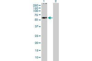 Western Blotting (WB) image for ABCC11 293T Cell Transient Overexpression Lysate(Denatured) (ABIN1338253)