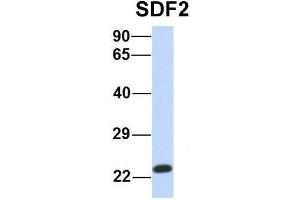 Host:  Rabbit  Target Name:  SDF2  Sample Type:  Human MCF7  Antibody Dilution:  1.