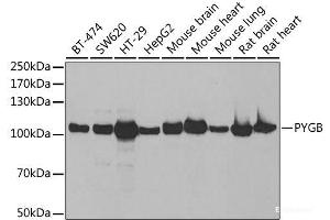 Western blot analysis of extracts of various cell lines using PYGB Polyclonal Antibody at dilution of 1:1000. (PYGB Antikörper)