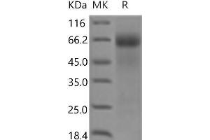 Western Blotting (WB) image for Fibroblast Growth Factor Receptor 4 (FGFR4) protein (His tag) (ABIN7321217)