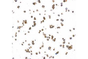 Immunocytochemistry (ICC) image for anti-Carcinoembryonic Antigen-Related Cell Adhesion Molecule 1/5 (CEACAM1/5) (AA 35-433) antibody (ABIN7455139) (Rekombinanter CEACAM1/5 Antikörper  (AA 35-433))
