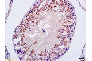 Formalin-fixed and paraffin embedded rat testis labeled with Anti-CYP21 Polyclonal Antibody, Unconjugated (ABIN740355) at 1:200, followed by conjugation to the secondary antibody and DAB staining (CYP21A2 Antikörper  (AA 101-200))