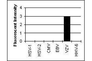 Cross Reactivity Results determined by IFA (Glycoprotein H (gH) Antikörper)