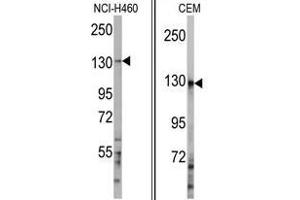 Image no. 1 for anti-Ubiquitination Factor E4A (UBE4A) (C-Term) antibody (ABIN357482) (UBE4A Antikörper  (C-Term))