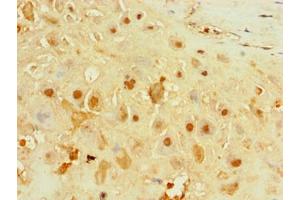Immunohistochemistry of paraffin-embedded human placenta tissue using ABIN7156651 at dilution of 1:100 (IFIH1 Antikörper  (AA 700-1025))