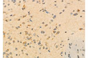 ABIN6260084 and ABIN6273196 at 1/100 staining Mouse brain tissue by IHC-P. (ASRGL1 Antikörper  (Internal Region))