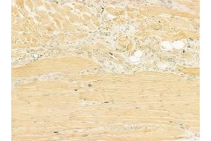 ABIN6260791 and ABIN6273208 at 1/100 staining human tongue carcinoma by IHC-P. (CHCHD4 Antikörper  (N-Term))