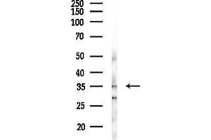 anti-HORMA Domain Containing 2 (HORMAD2) antibody