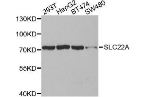 Western blot analysis of extracts of various cell lines, using SLC22A8antibody. (SLC22A8 Antikörper)