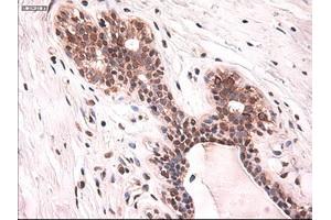 Immunohistochemical staining of paraffin-embedded breast using anti-KRT18 (ABIN2452674) mouse monoclonal antibody. (Cytokeratin 18 Antikörper  (AA 69-372))