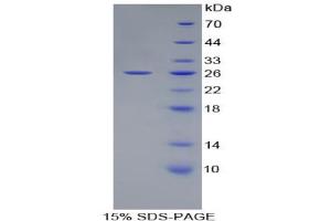 SDS-PAGE analysis of Rat ATF4 Protein. (ATF4 Protein)