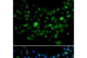 Immunofluorescence analysis of A549 cells using MCM10 Polyclonal Antibody (MCM10 Antikörper)