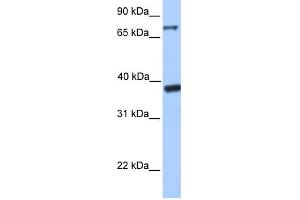 WB Suggested Anti-DIDO1 Antibody Titration:  0.