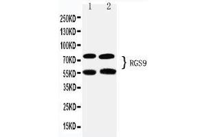 Anti-RGS9 antibody, Western blotting Lane 1: Rat Brain Tissue Lysate Lane 2: Mouse Brain Tissue Lysate (RGS Antikörper  (C-Term))