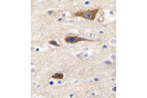 Formalin-fixed and paraffin-embedded human brain tissue reacted with CYP2R1 antibody , which was peroxidase-conjugated to the secondary antibody, followed by DAB staining. (CYP2R1 Antikörper  (AA 152-180))