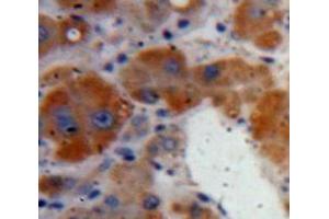 IHC-P analysis of Liver tissue, with DAB staining. (Clusterin Antikörper  (AA 227-447))