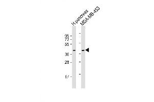Western Blot at 1:2000 dilution Lane 1: human pancreas lysate Lane 2: MDA-MB-453 whole cell lysate Lysates/proteins at 20 ug per lane. (HHLA2 Antikörper  (N-Term))