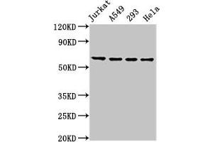 Western Blot Positive WB detected in: Jurkat whole cell lysate, A549 whole cell lysate, 293 whole cell lysate, Hela whole cell lysate All lanes: TAF15 antibody at 8. (TAF15 Antikörper  (AA 93-206))