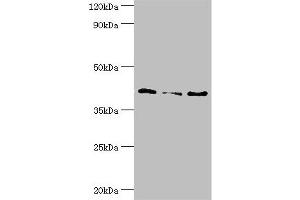 Western blot All lanes: Serpin B5 antibody at 10 μg/mL Lane 1: HepG2 whole cell lysate Lane 2: Hela whole cell lysate Lane 3: A431 whole cell lysate Secondary Goat polyclonal to rabbit IgG at 1/10000 dilution Predicted band size: 43, 26 kDa Observed band size: 43 kDa (SERPINB5 Antikörper  (AA 21-189))