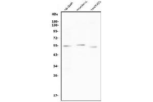 Western blot analysis of CCNB1 using anti-CCNB1 antibody (ABIN7599335). (Cyclin B1 Antikörper  (AA 1-383))