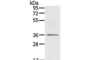 Western Blot analysis of TM4 cell using p53RFP Polyclonal Antibody at dilution of 1:400 (RNF144B Antikörper)
