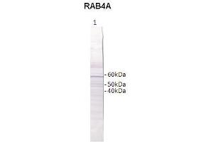 Western Blotting (WB) image for anti-RAB4B, Member RAS Oncogene Family (RAB4B) (Middle Region) antibody (ABIN2788152) (RAB4B Antikörper  (Middle Region))