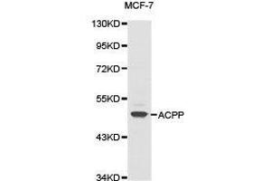 Western Blotting (WB) image for anti-Acid Phosphatase, Prostate (ACPP) antibody (ABIN1870774) (ACPP Antikörper)