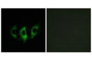 Immunofluorescence analysis of A549 cells, using GFM2 antibody. (GFM2 Antikörper)