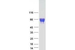 Western Blotting (WB) image for Caspase Recruitment Domain Family, Member 9 (CARD9) (Transcript Variant 1) protein (Myc-DYKDDDDK Tag) (ABIN2713168)