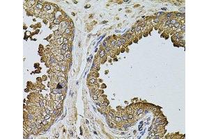 Immunohistochemistry of paraffin-embedded Human prostate using MTIF3 Polyclonal Antibody at dilution of 1:100 (40x lens).