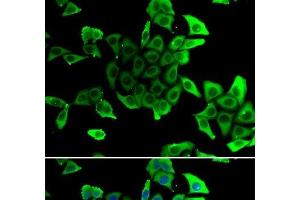 Immunofluorescence analysis of U2OS cells using SGCD Polyclonal Antibody (SGCD Antikörper)
