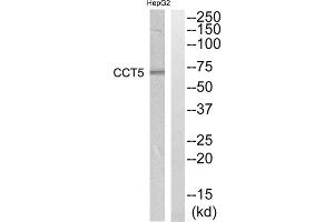 Western blot analysis of extracts from HepG2 cells, using CCT5 antibody. (CCT5 Antikörper  (Internal Region))