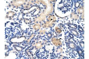 EMG1 antibody was used for immunohistochemistry at a concentration of 4-8 ug/ml to stain Epithelial cells of renal tubule (arrows) in Human Kidney. (EMG1 Antikörper)