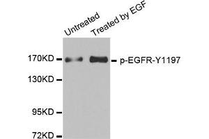 Western Blotting (WB) image for anti-Epidermal Growth Factor Receptor (EGFR) (pTyr1197) antibody (ABIN1870128) (EGFR Antikörper  (pTyr1197))