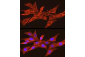 Immunofluorescence analysis of NIH/3T3 cells using CSNK2 Rabbit pAb (ABIN3022252, ABIN3022253, ABIN3022254 and ABIN6218695) at dilution of 1:100 (40x lens). (CSNK2A2 Antikörper  (AA 1-350))