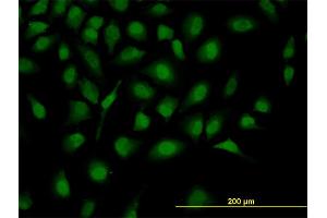 Immunofluorescence (IF) image for anti-Zinc Fingers and Homeoboxes 2 (ZHX2) (AA 691-788) antibody (ABIN564953)