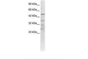 Image no. 1 for anti-Acetylcholine Receptor Subunit alpha (CHRNA1) (AA 25-74) antibody (ABIN6735455) (CHRNA1 Antikörper  (AA 25-74))