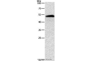 Western blot analysis of Human liver cancer tissue, using ALDH1B1 Polyclonal Antibody at dilution of 1:900