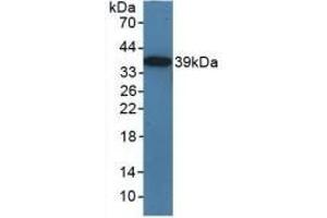 Detection of Recombinant TICAM1, Mouse using Polyclonal Antibody to Toll Like Receptor Adaptor Molecule 1 (TICAM1) (TICAM1 Antikörper  (AA 263-526))