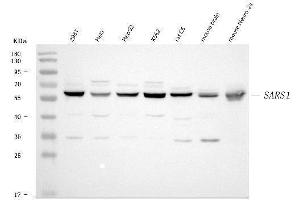Western blot analysis of Seryl-TRNA Synthetase/SERS/SARS1 using anti-Seryl-TRNA Synthetase/SERS/SARS1 antibody (ABIN7602365).