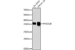 Western blot analysis of extracts of various cell lines, using PHOX2B Rabbit mAb (ABIN7269159) at 1:1000 dilution. (PHOX2B Antikörper)
