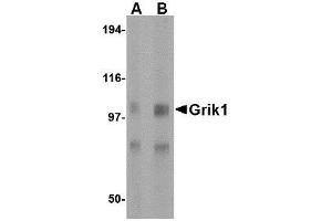 Western blot analysis of Grik1 in rat brain tissue lysate with AP30381PU-N Grik1 antibody at (A) 0. (GRIK1 Antikörper  (Center))
