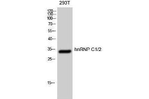 Western Blotting (WB) image for anti-Heterogeneous Nuclear Ribonucleoprotein C (C1/C2) (HNRNPC) (Ser484) antibody (ABIN3185059) (HNRNPC Antikörper  (Ser484))