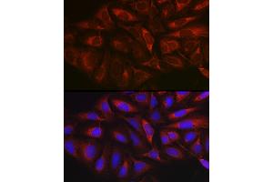 Immunofluorescence (IF) image for anti-Myristoylated Alanine-Rich Protein Kinase C Substrate (MARCKS) (AA 1-100) antibody (ABIN6143555)
