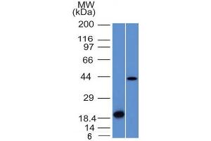 Western Blot Analysis (A) Recombinant Protein (B) Human Liver lysate Aurora B Mouse Monoclonal Antibody (AURKB/1521). (Aurora Kinase B Antikörper  (AA 89-251))