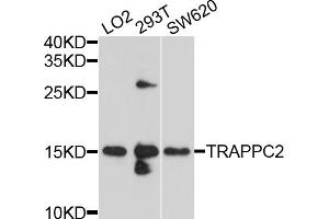 Western blot analysis of extracts of various cell lines, using TRAPPC2 antibody (ABIN4905483) at 1:1000 dilution. (TRAPPC2 Antikörper)