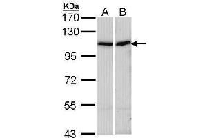 WB Image Sample (30 ug of whole cell lysate) A: A431 , B: Hep G2 , 7. (alpha Actinin 4 Antikörper)